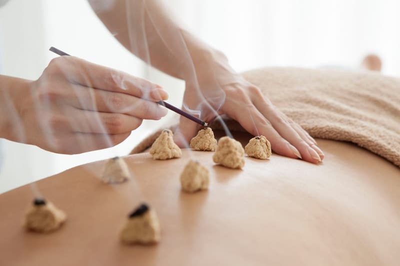 Moxibustion image