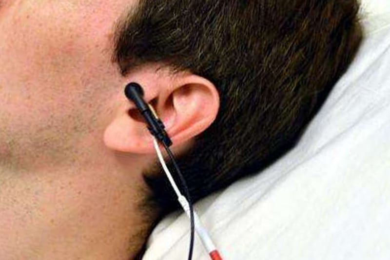 Vagus Nerve Stimulation